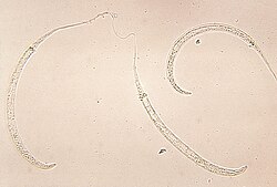 Dracunculus medinensis - ličinke