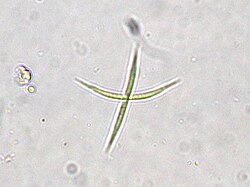 Actinastrum hantzschii