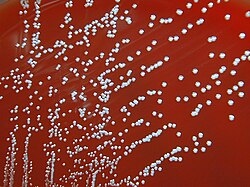 Kolonije Brucelle melitensis