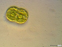 Actinotaenium globosum