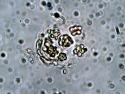 Sphaerocystis schroeteri