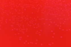 kolonije bakterije Erysipelothrix rhusiopathiae na hranjivoj podlozi (krvni agar)