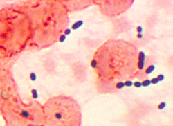Enterococcus sp. u plućnom tkivu.