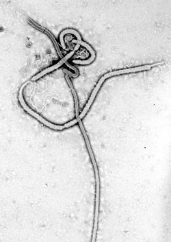 Ebola virus - elektronski mikroskopom